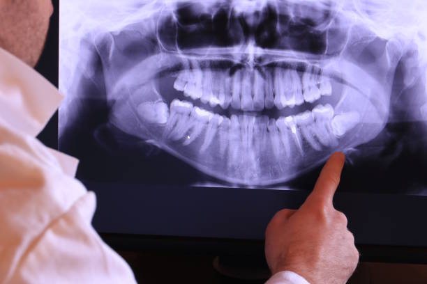 Best Knocked-Out Tooth Emergency  in Lmar, DE